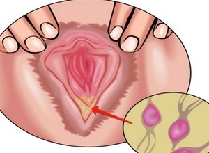 як вылучаецца змазка